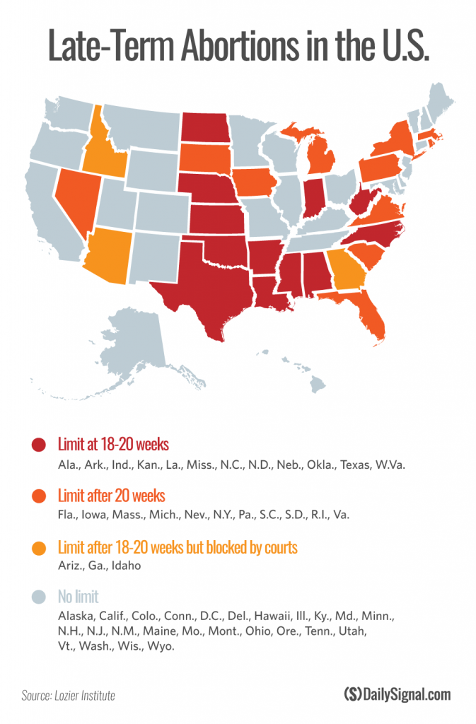 Where Does Your State Stand on LateTerm Abortions?