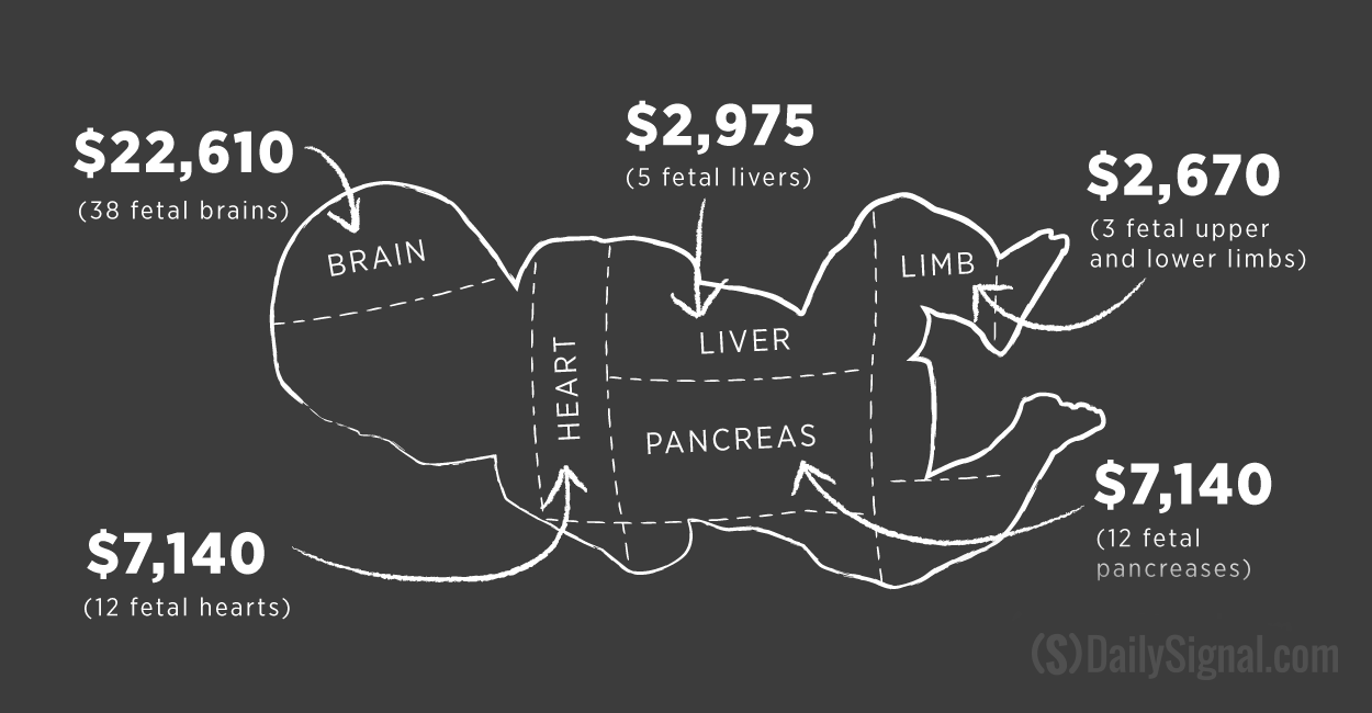 Organ Price Chart