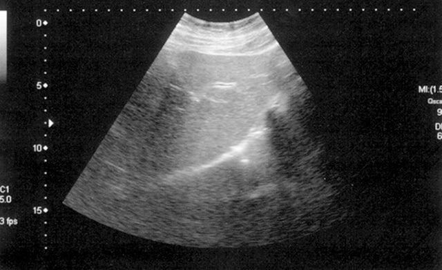 29 Beautiful Reminders of Why People March for Life 20 29 Beautiful Reminders of Why People March for Life