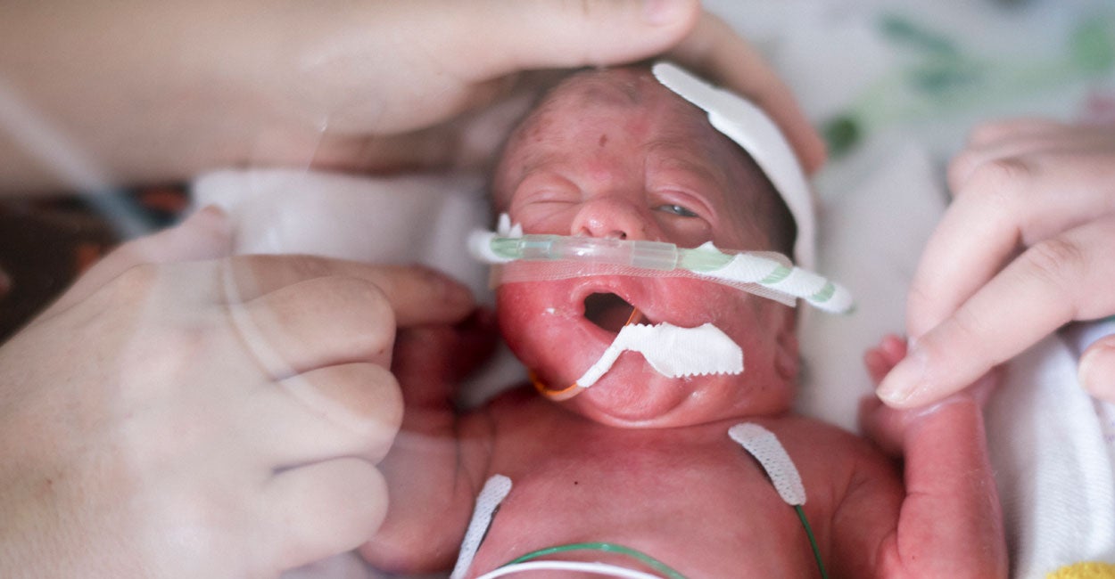 Podcast Born at 29 Weeks, This Young American Talks About LateTerm