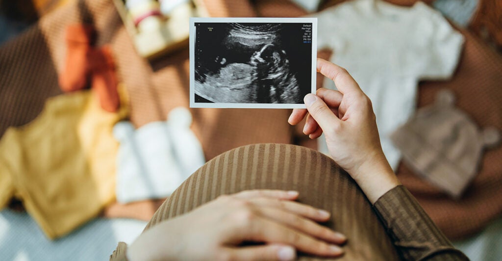 A pregnant woman looks at an ultrasound image of her unborn baby.