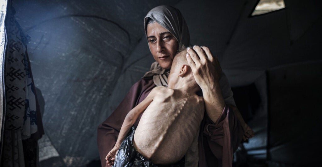 A Palestinian woman holds a child diagnosed with pre-existing congenital health issues, including brain complications and muscle atrophy.