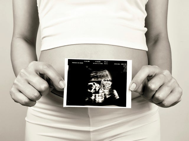 29 Beautiful Reminders of Why People March for Life 28 29 Beautiful Reminders of Why People March for Life