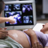 Help for Unintended Pregnancy